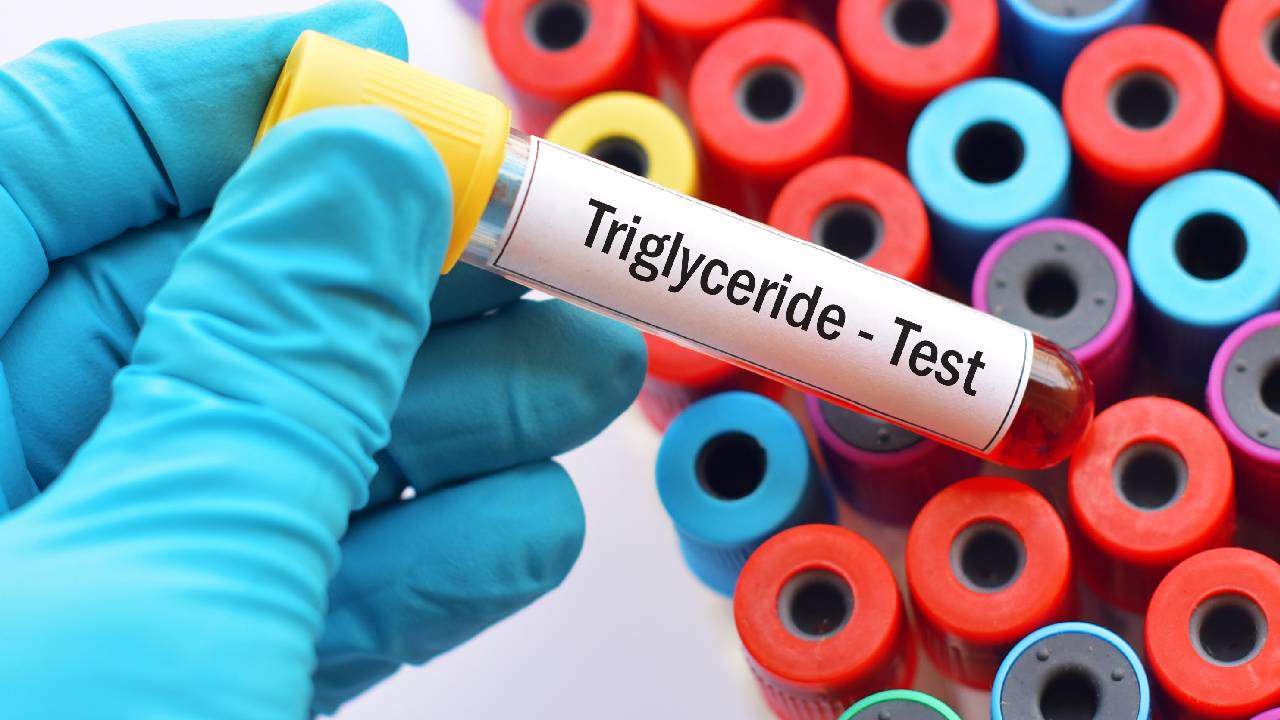 Una sana alimentación es fundamental para evitar el aumento en el nivel de los triglicéridos. Foto: GettyImages.