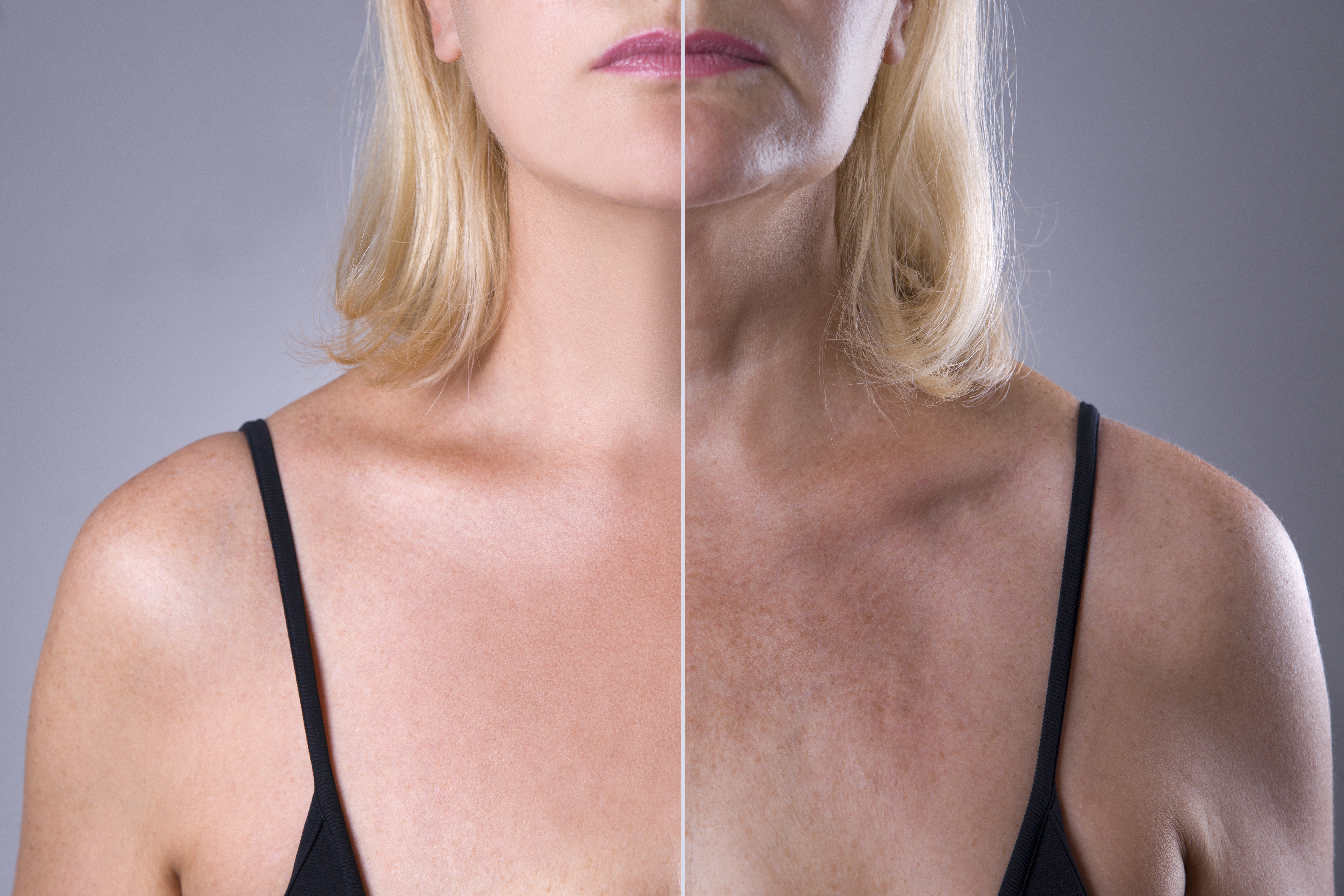 Arrugas y cicatrices: cómo usar vaselina y limón para eliminarlas
