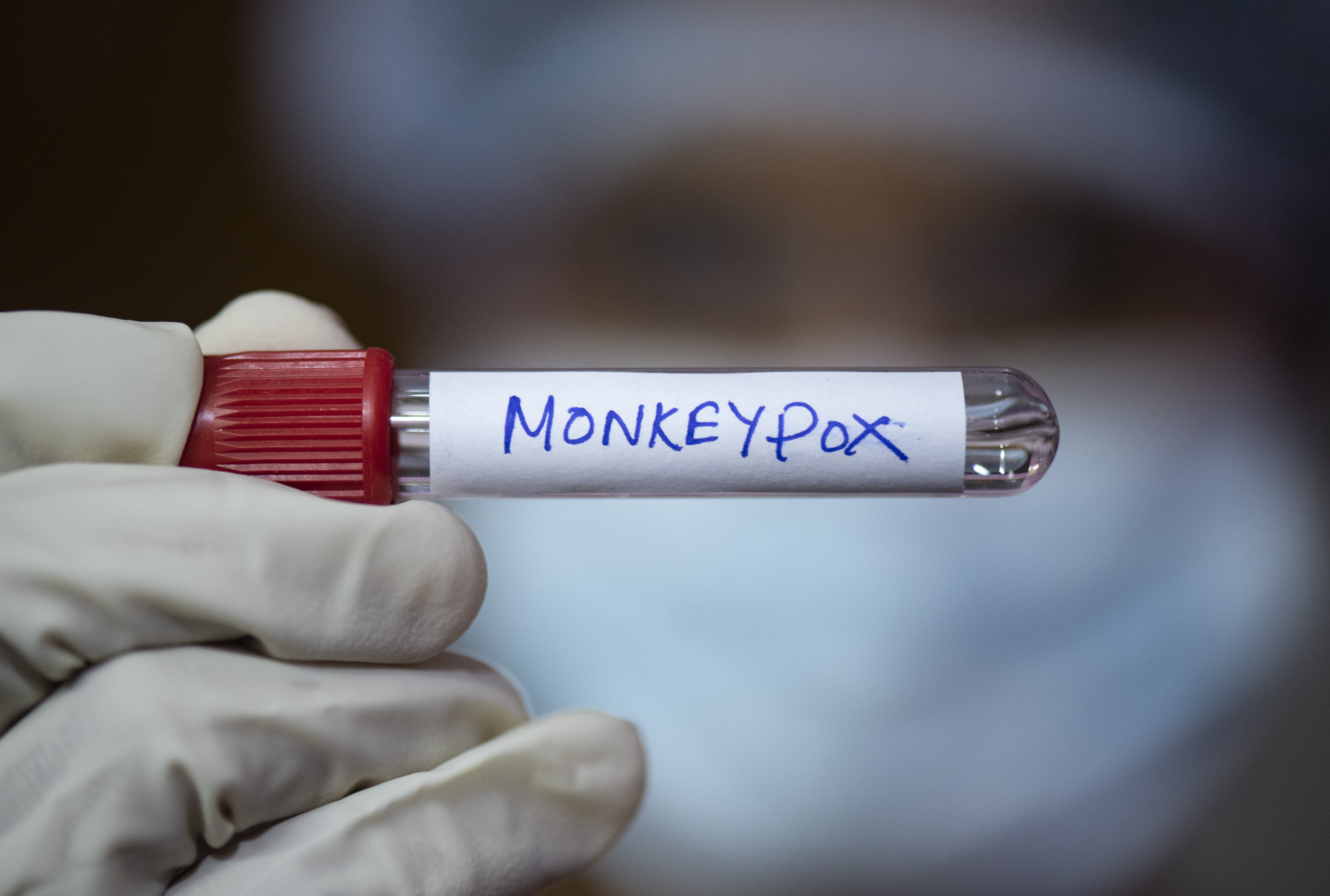Monkeypox virus o viruela del mono