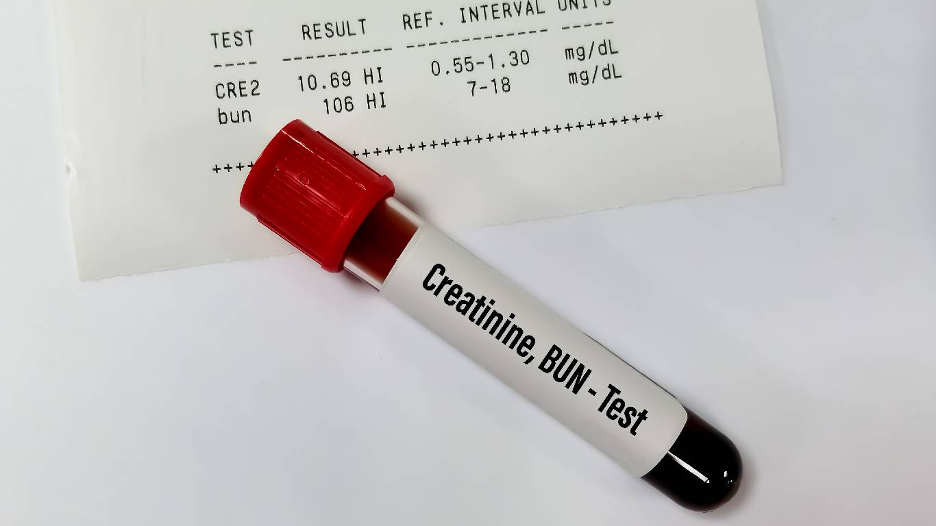 La creatinina es una sustancia producida por los músculos, la cual es eliminada por los riñones a través de la orina. Foto: Getty Images.