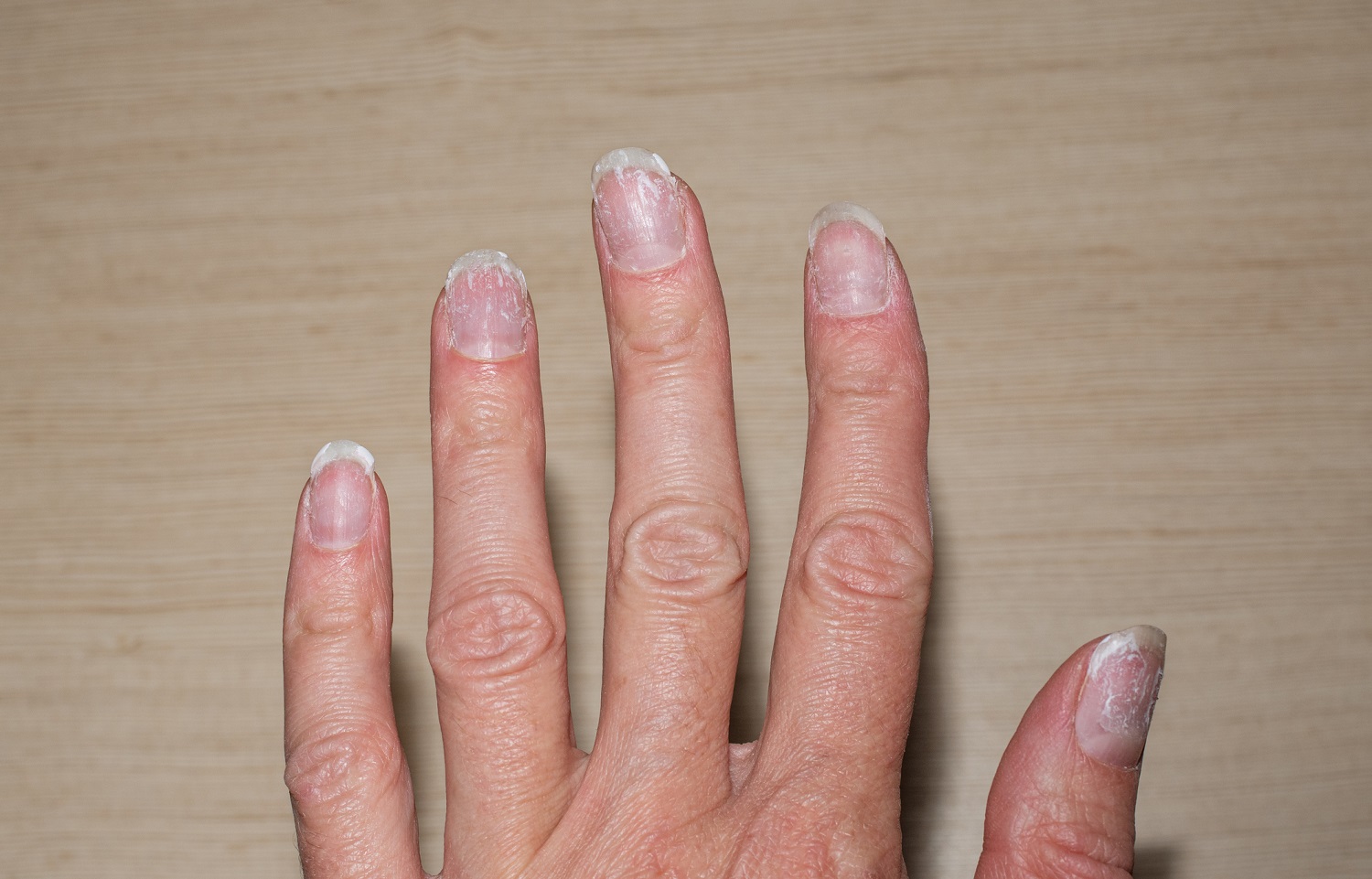 El motivo por el que tienes manchas y líneas blancas en las uñas