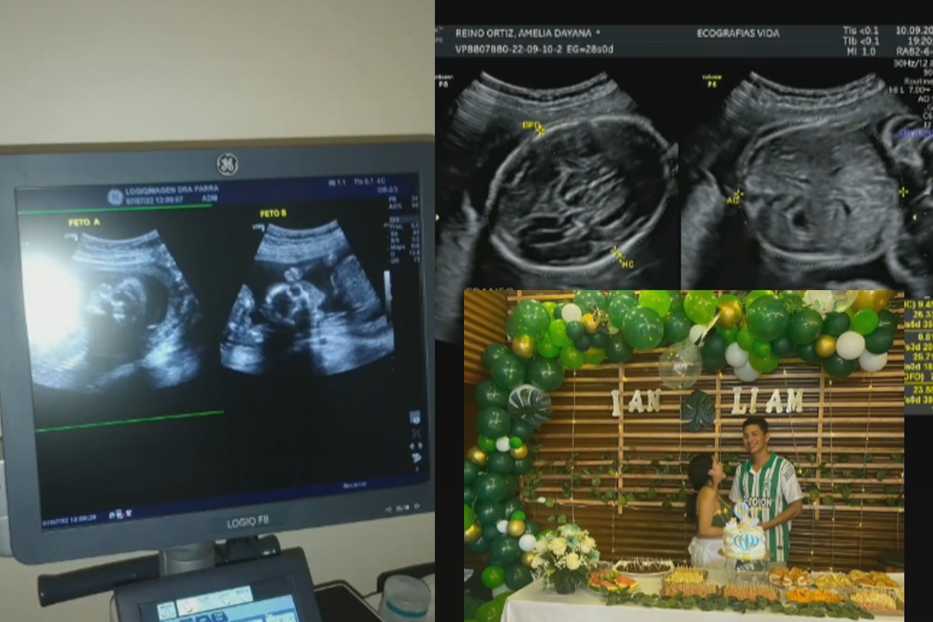 La mujer compartió sus ecografías en TikTok.