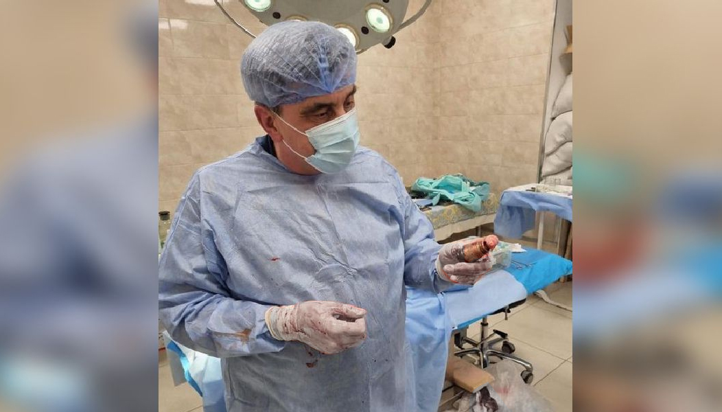 La cirugía representaba un gran riesgo en tanto la granada estaba sin estallar.