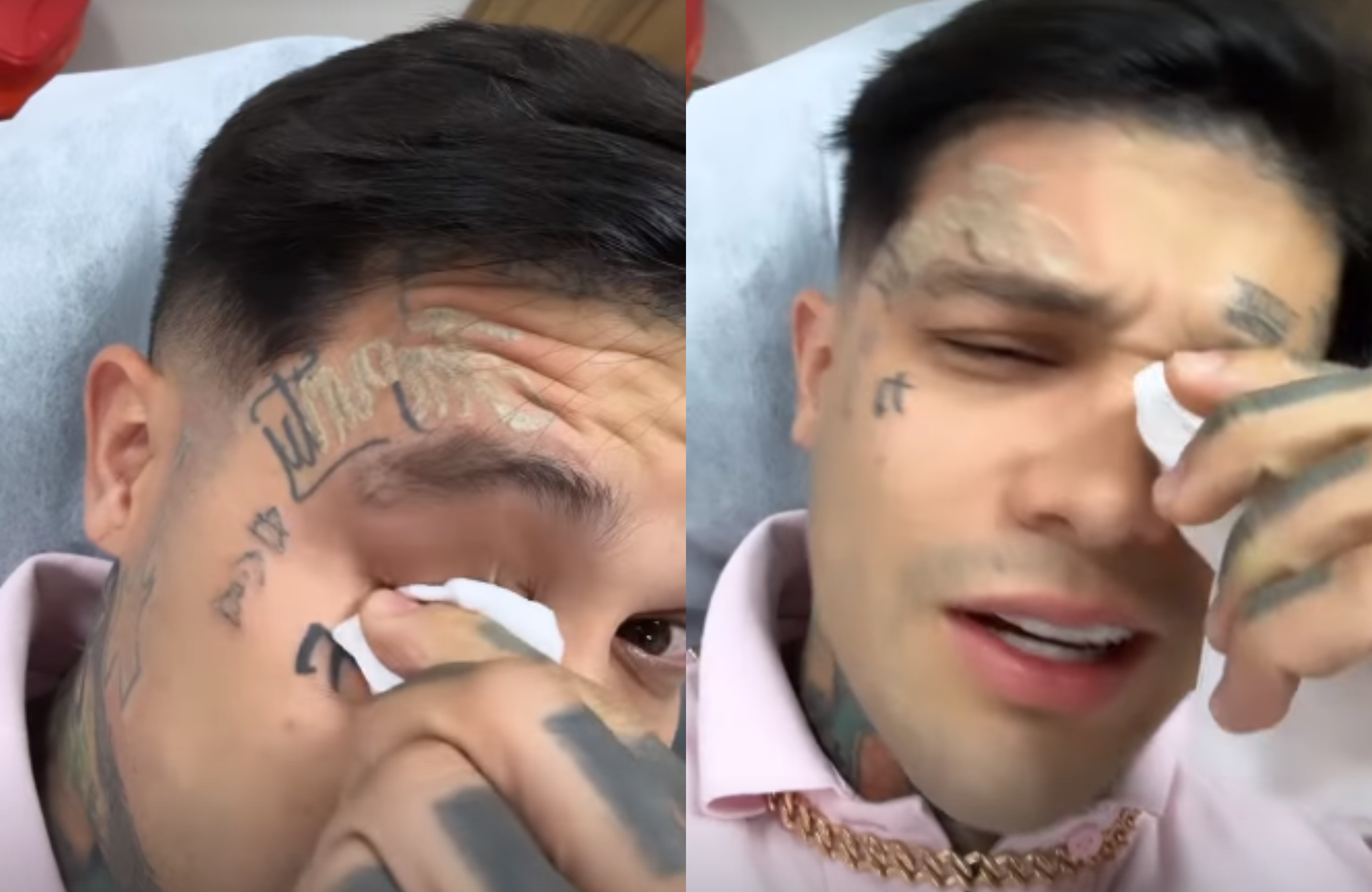 Estoy lagrimeando, duele mucho”: Yéferson Cossio decidió borrar los  tatuajes de su rostro