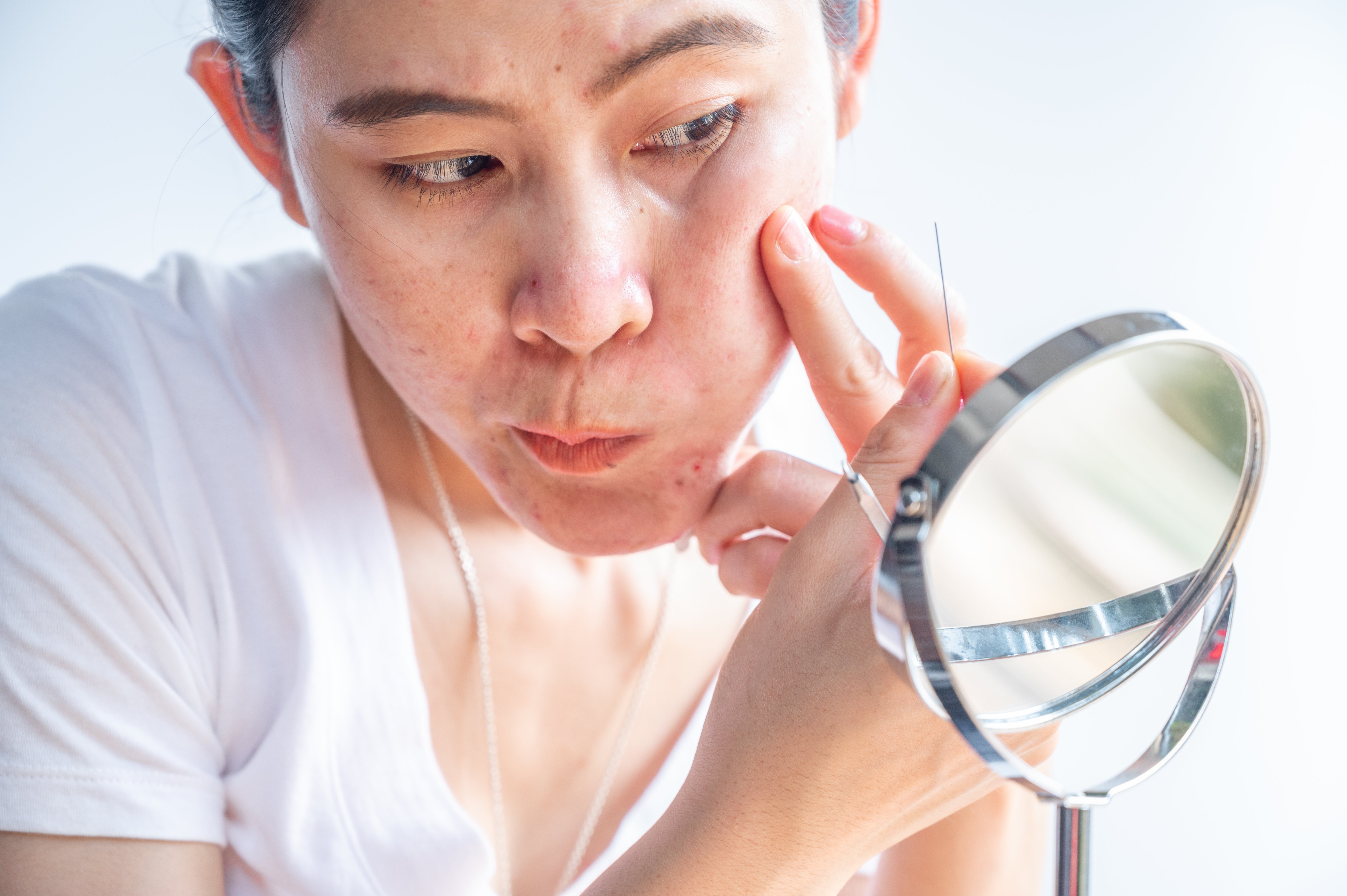 La exposición del sol puede provocar la aparición de manchas en el rostro.