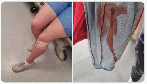 Delincuentes robaron e hirieron a esposa del concejal Javier Ospina.