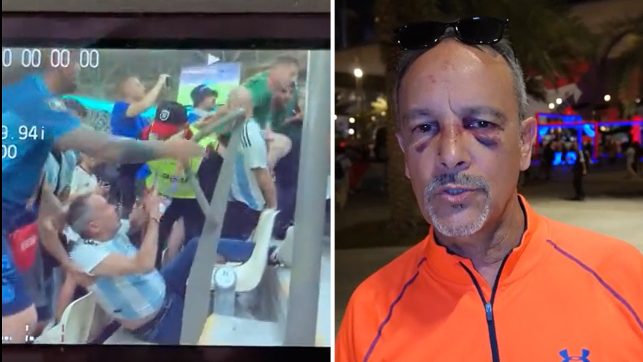 Luis Aguirre recibió reiterados golpes en la cara antes del partido entre México y Argentina