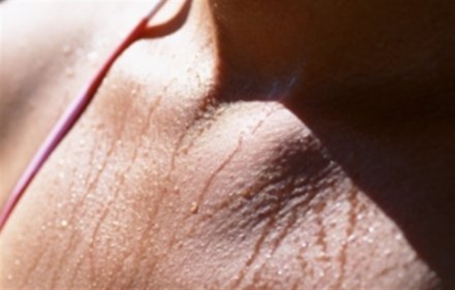 El sudor es básicamente agua con sales y ácidos en bajas proporciones 