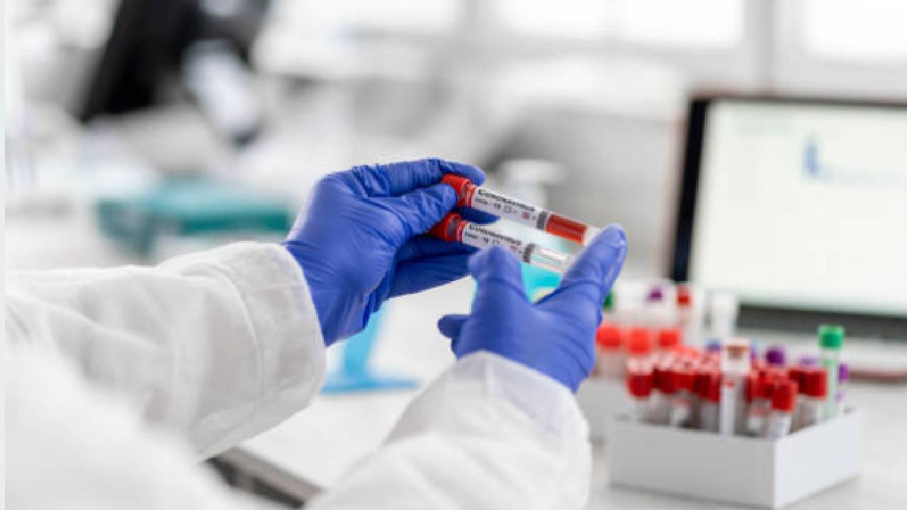 La lucha contra el VIH se ha visto afectada por el coronavirus: OMS