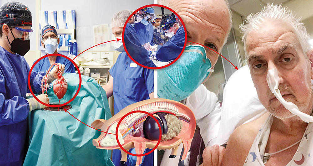 Bennett optó por el tratamiento experimental, pues había agotado otras alternativas y estaba muy enfermo.