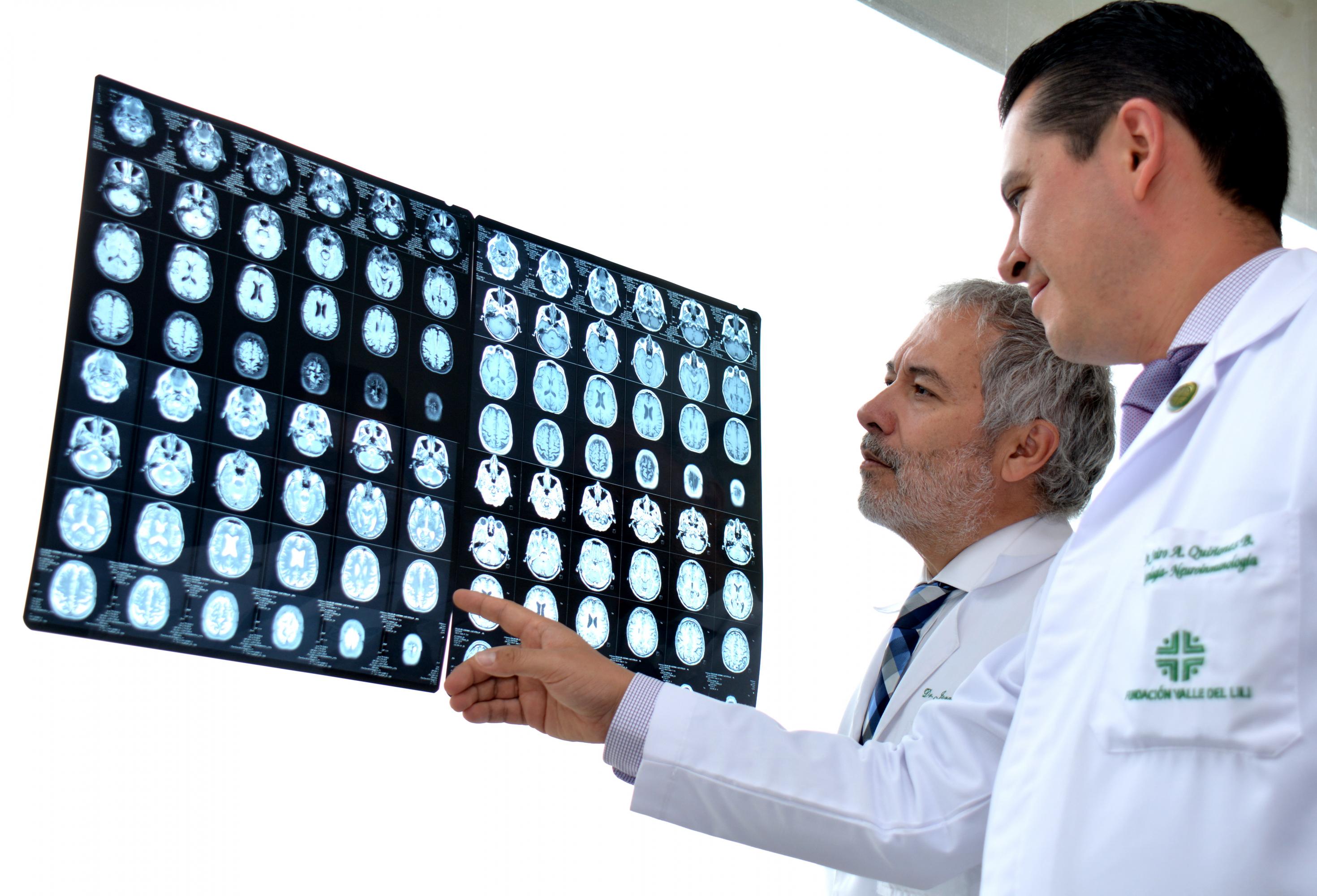 Los neurólogos de la Fundación Valle del Lili realizan juntas médicas multidisciplinarias periódicas, académicas y asistenciales para los casos de patologías de alta prevalencia e importancia, como son la epilepsia, Parkinson, esclerosis múltiple, entre otras.