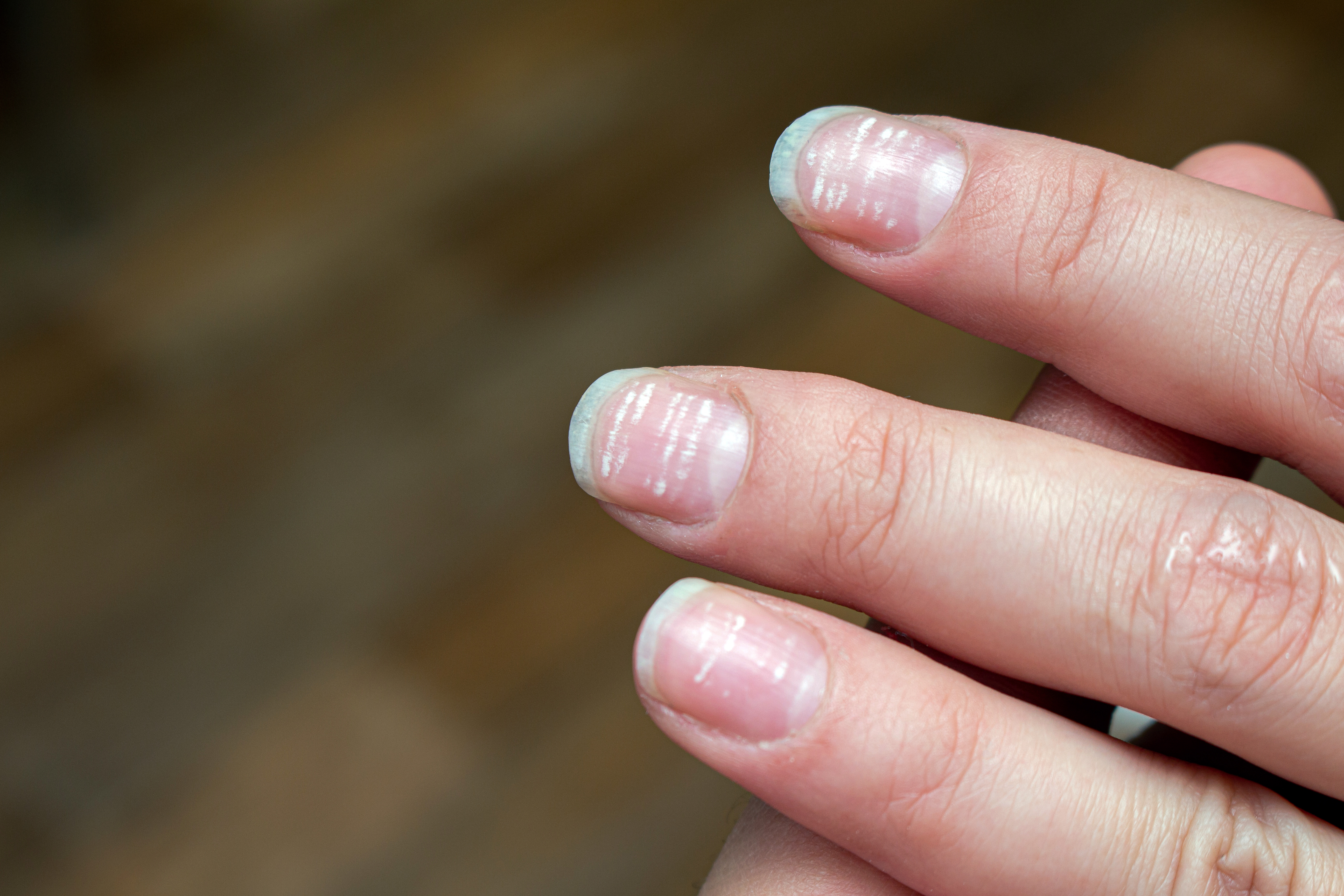 Cómo tratar las uñas con estrías  7 pasos