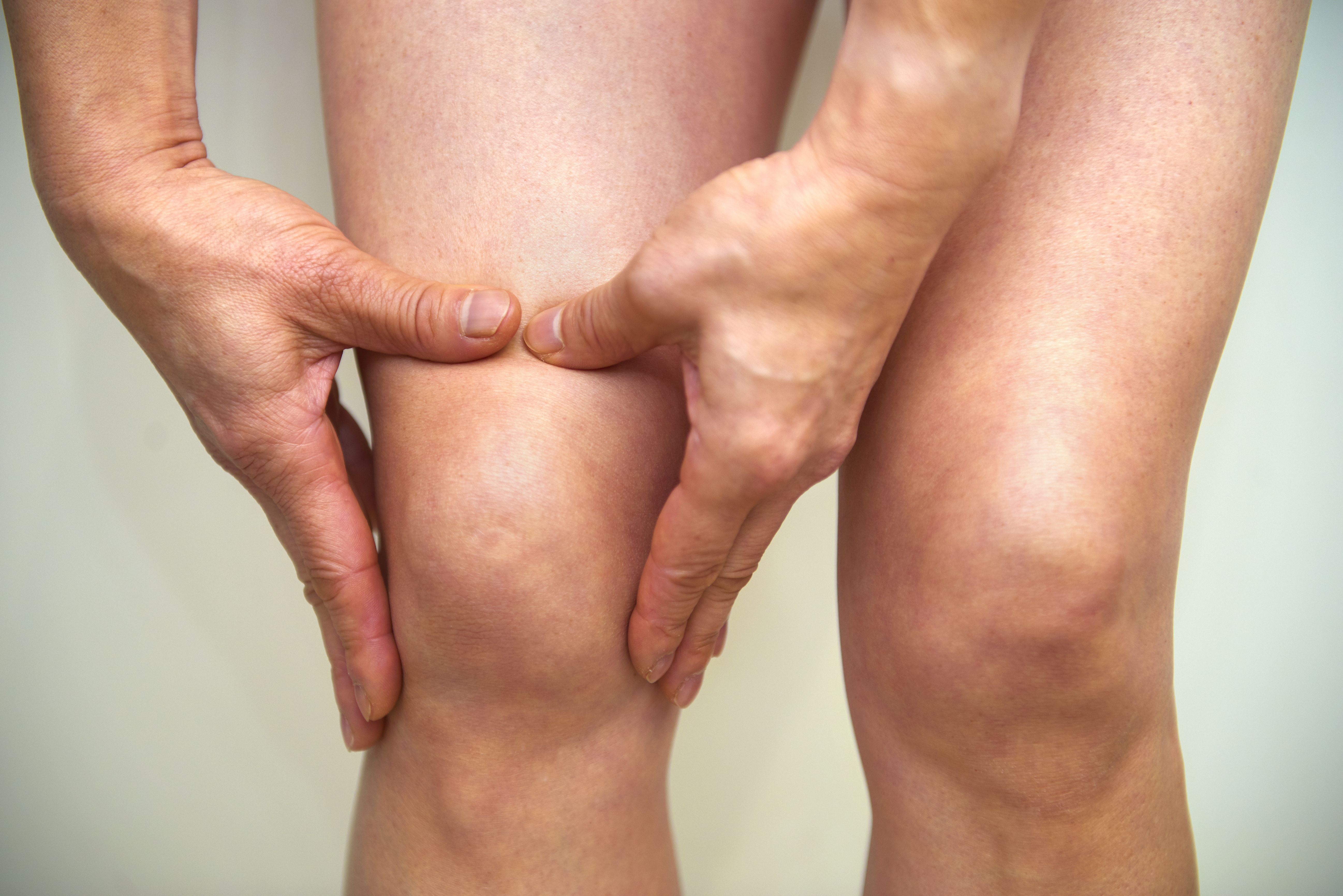 Por qué las mujeres son más propensas a la mala circulación en las piernas  que los hombres? Le contamos detalles