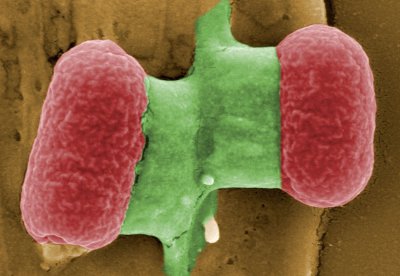 Imagen tomada mediante un microscopio electrónico una bacteria EHEC, una cepa de la bacteria Escherichia coli de alta resistencia a los antibióticos. 