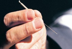 De acuerdo con la concepción china, la energía vital (ch'í, o qi) , fluye por el cuerpo a lo largo de meridianos, canales o vías de comunicación, llamados en chino King