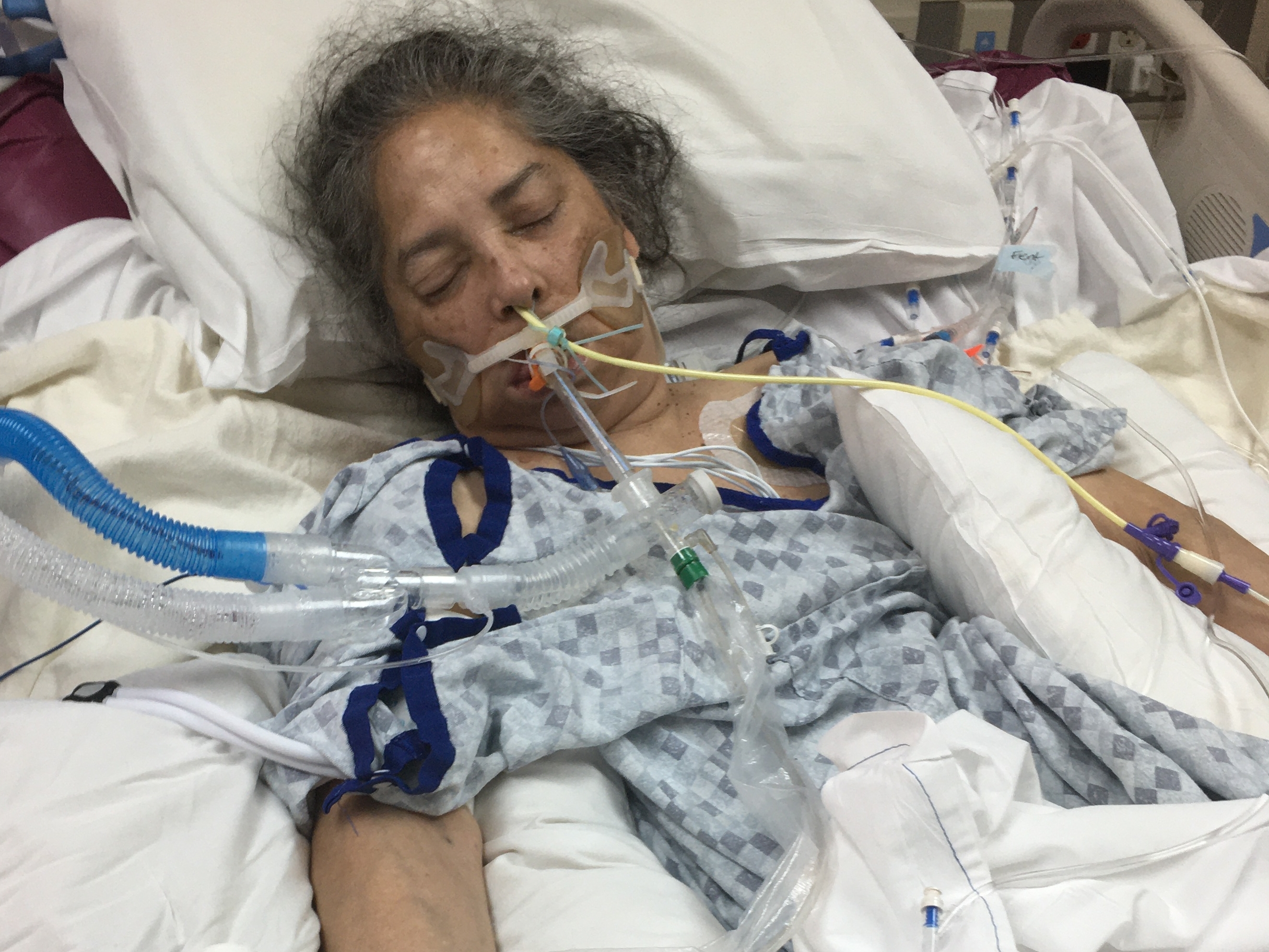 After his wife was put on a ventilator, a husband faced an agonizing  decision: Should he do whatever it took for her to wake up?