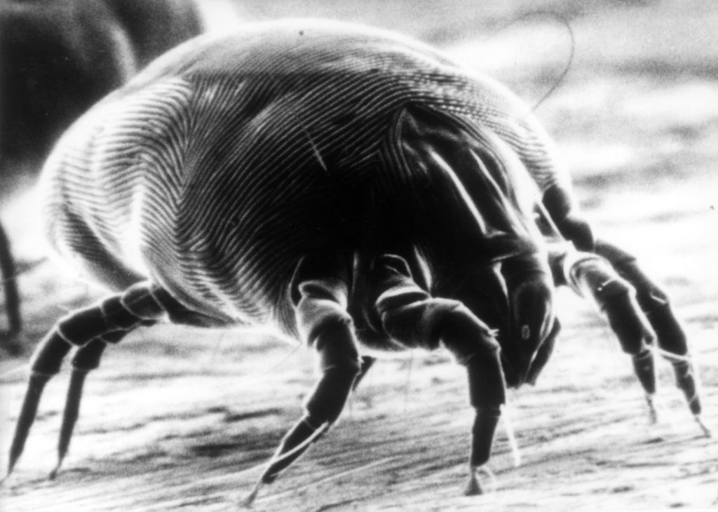 Pillow talk Does extreme cold kill dust mites?