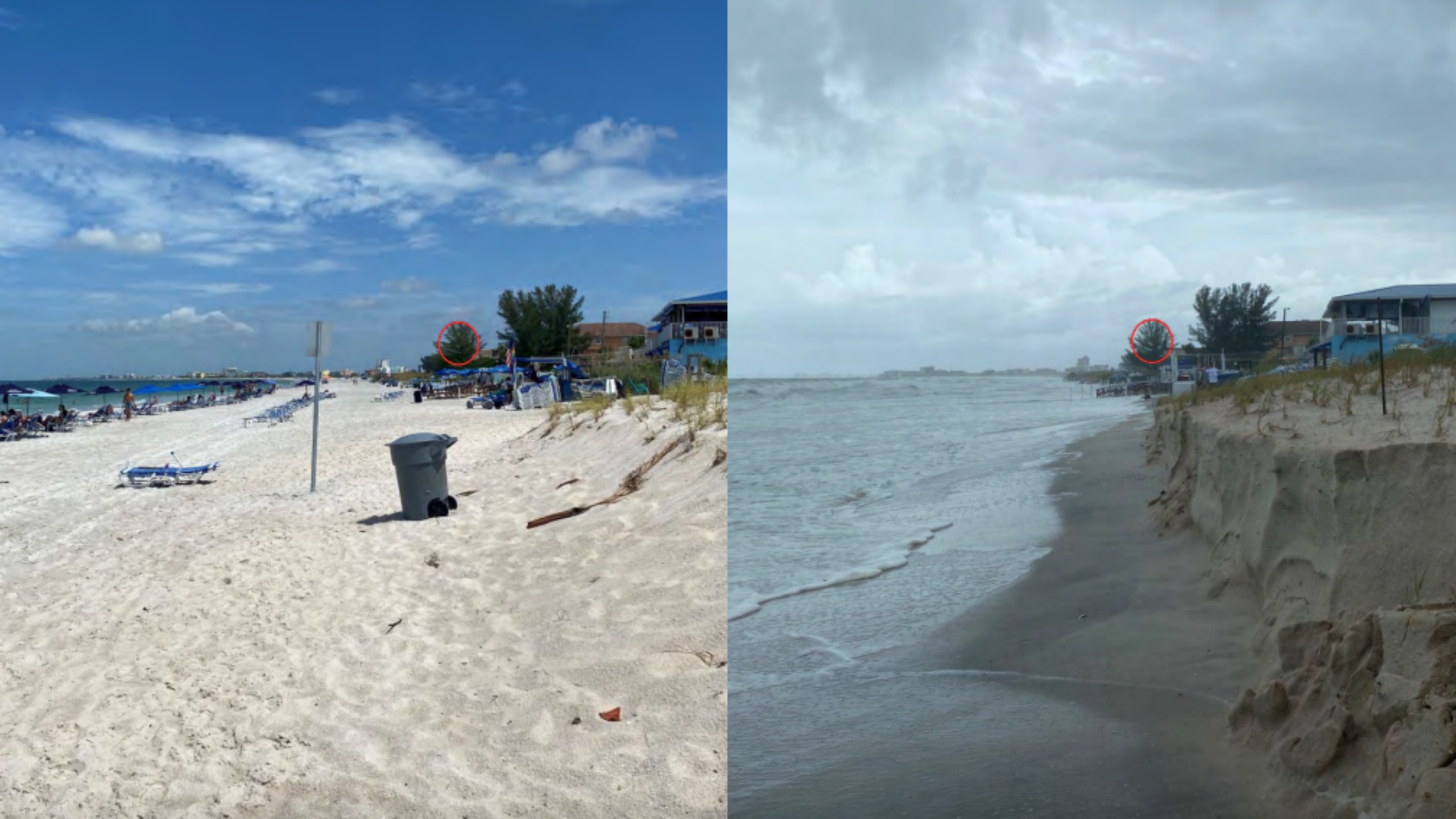 Erosion Before And After Photos
