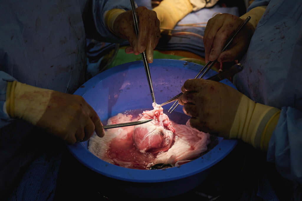 Pig-human transplants may be a misguided attempt to address the organ  shortage