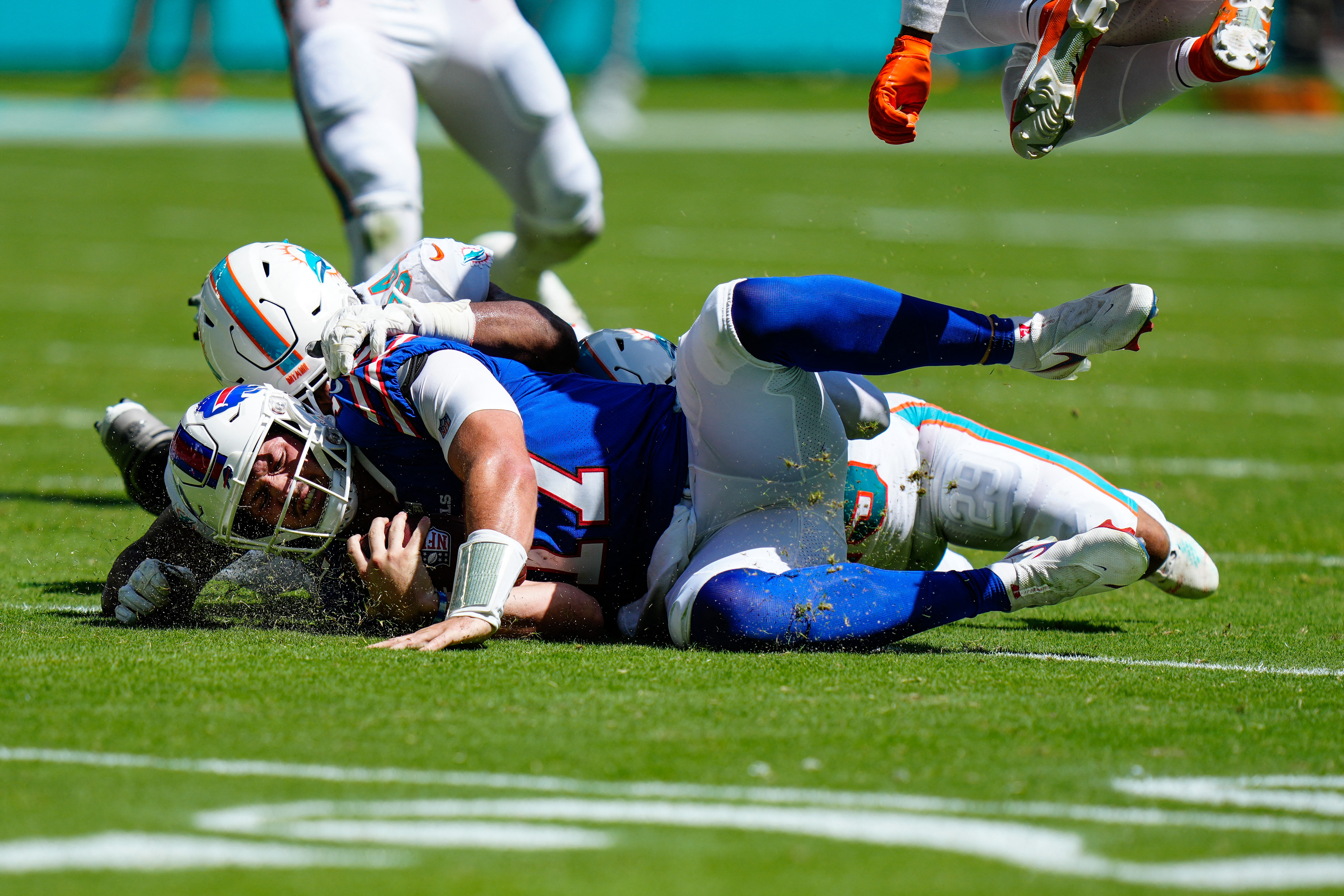 Buffalo Bills can't overcome injuries and mistakes, fall to Dolphins 21-19