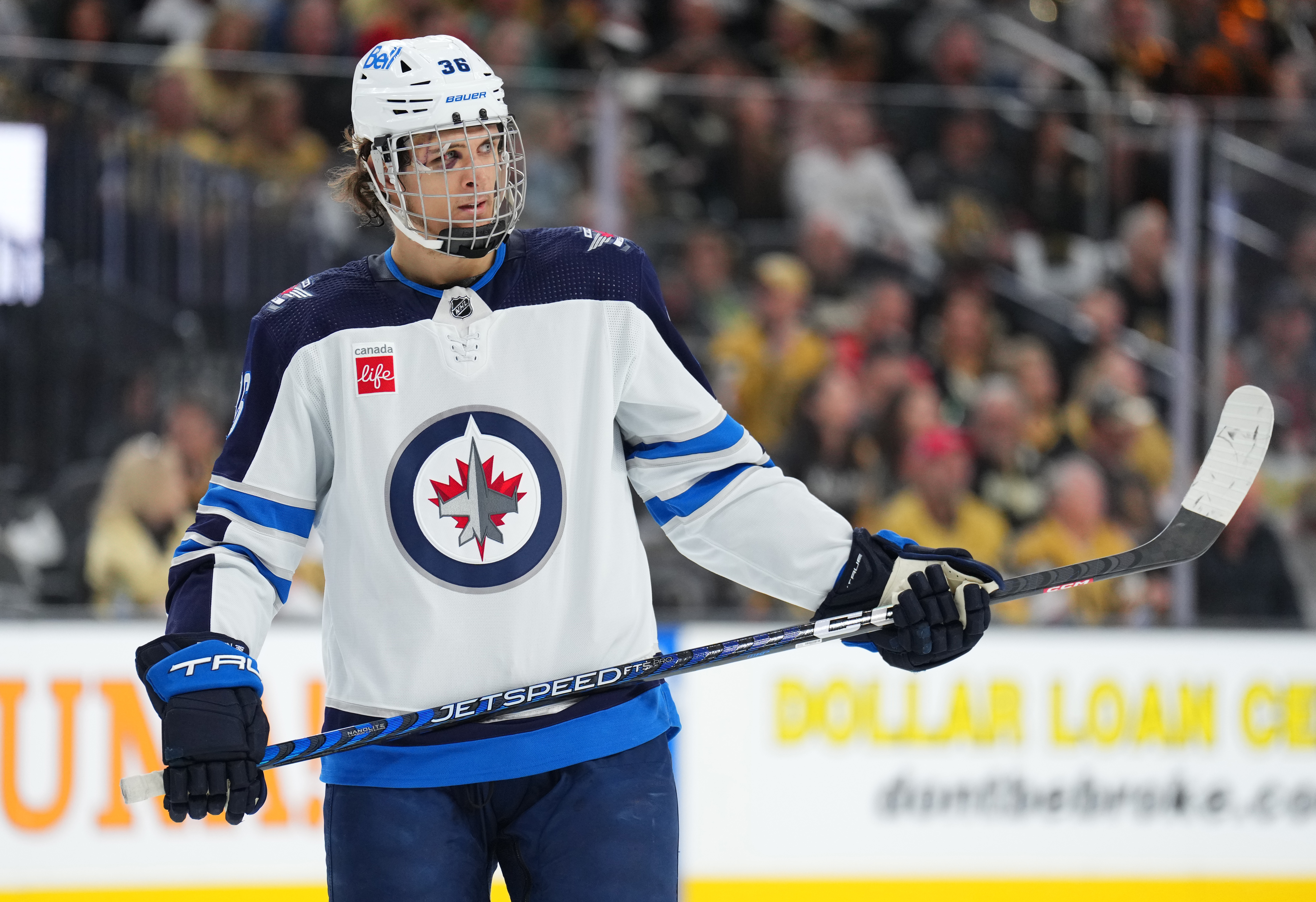 Winnipeg Jets' Morgan Barron gets 75 stitches after getting cut by