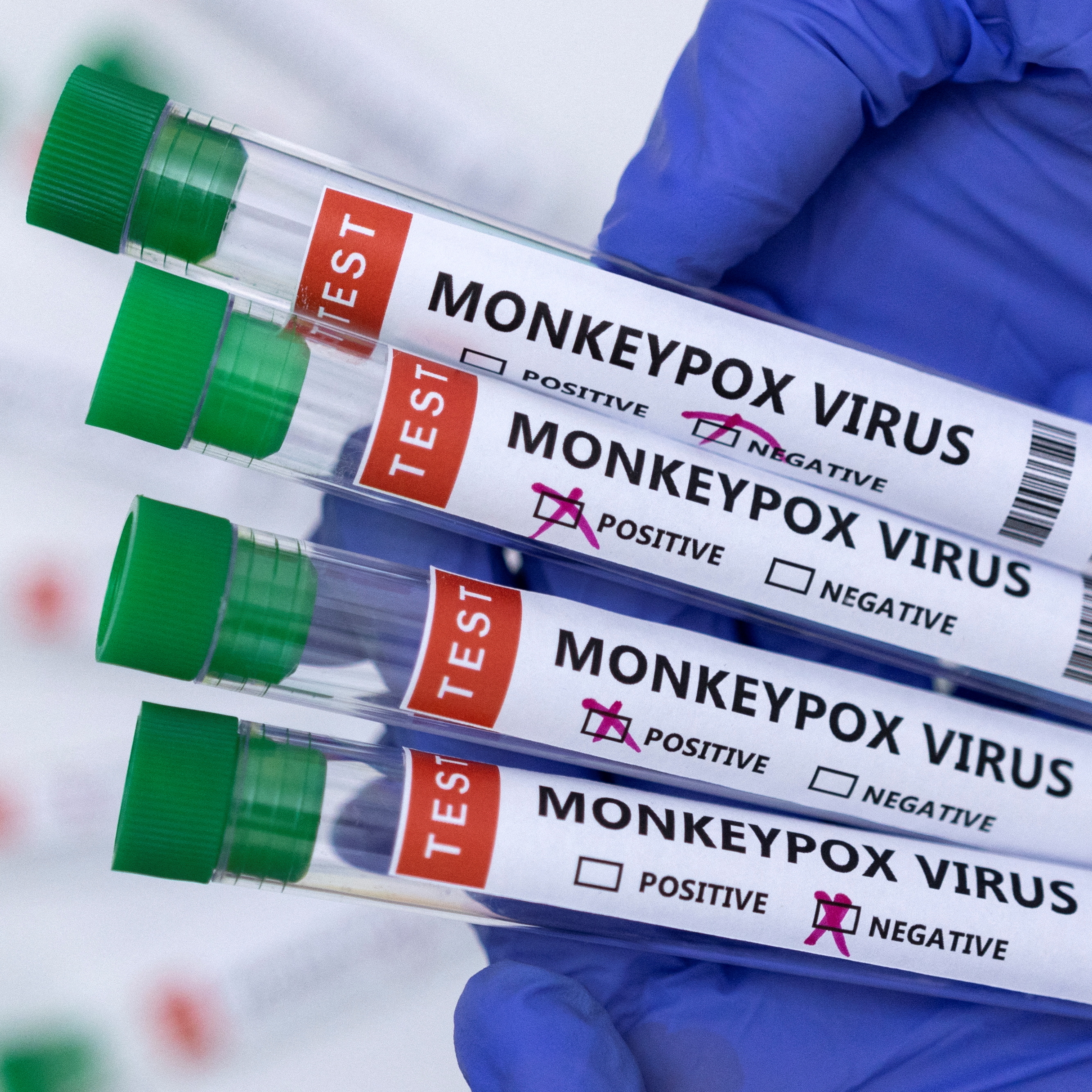 Deadly mpox Virus Found in Luggage at Michigan Airport