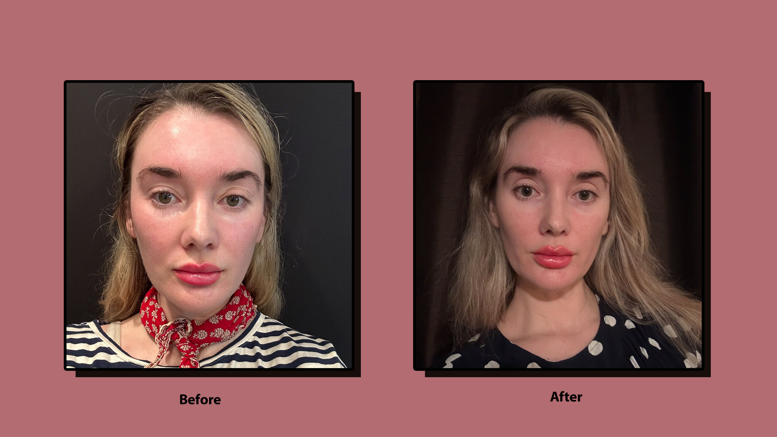losing weight without glp 1 How You Can Lose Weight Without a GLP-1