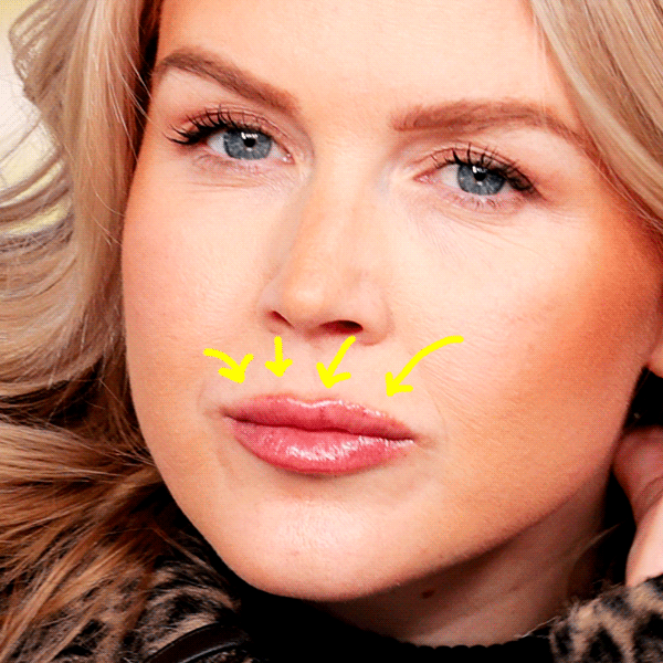 Karoline Leavitt's Cosmetic Secrets Brutally Exposed in Vanity Fair Shoot