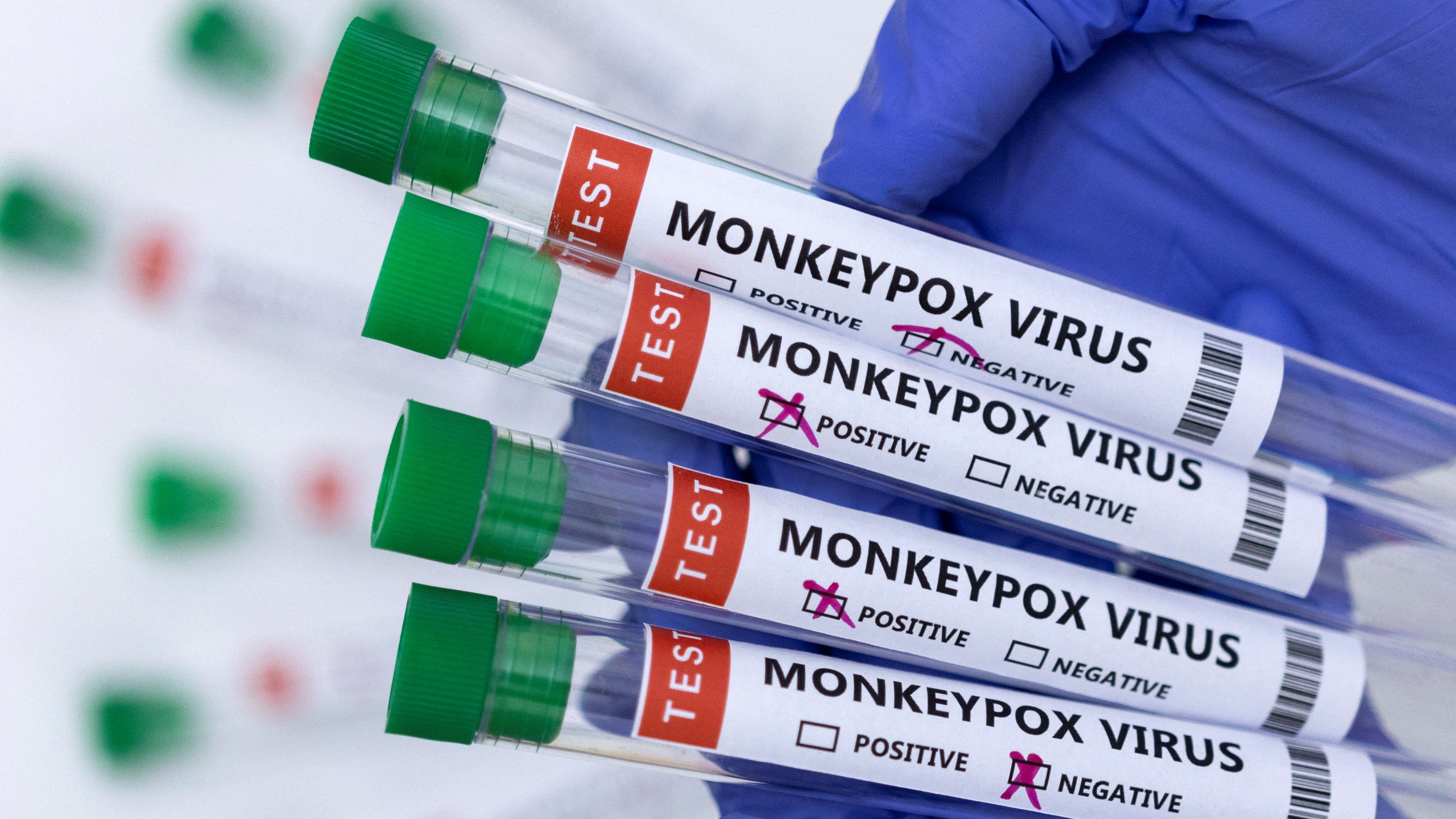 Deadly mpox Virus Found in Luggage at Michigan Airport