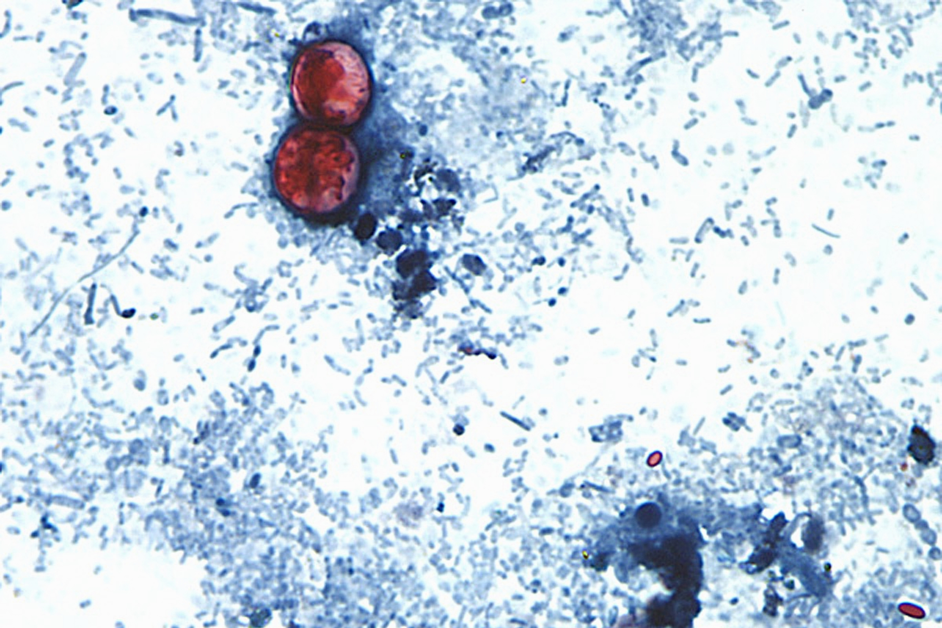 A photo taken through a microscope shows cyclospora oocysts found in a fresh stool sample that had been prepared with a formalin solution and stained with safranin. (CDC/AP)