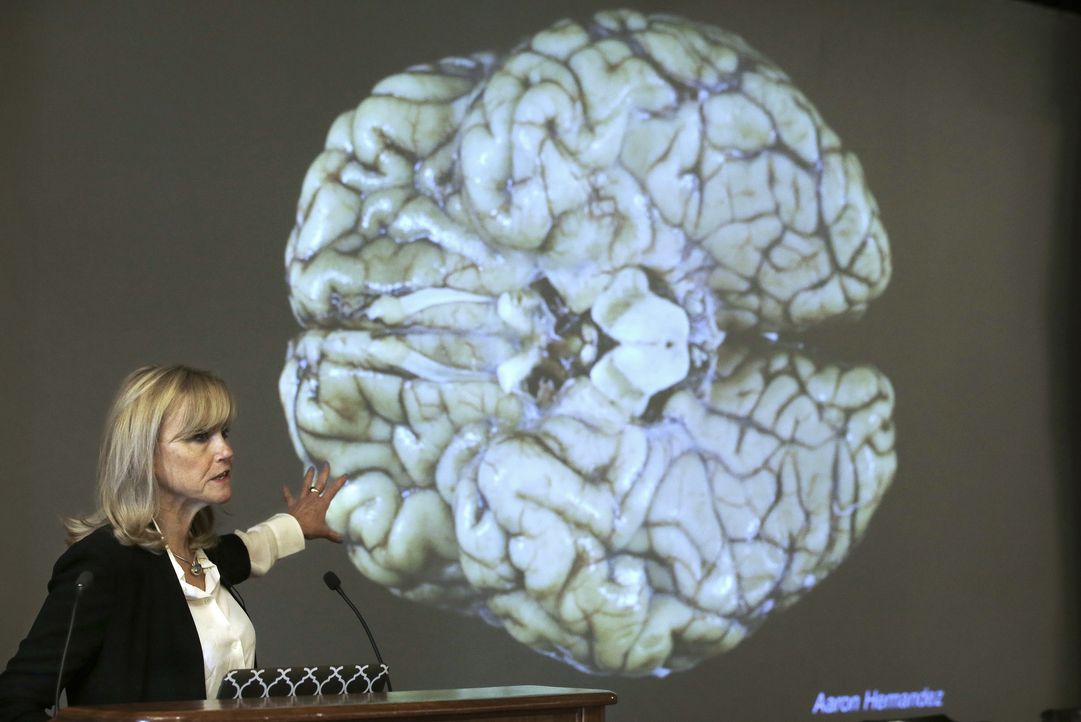 Ann McKee, director of Boston University’s Chronic Traumatic Encephalopathy Center. (Steven Senne/AP)