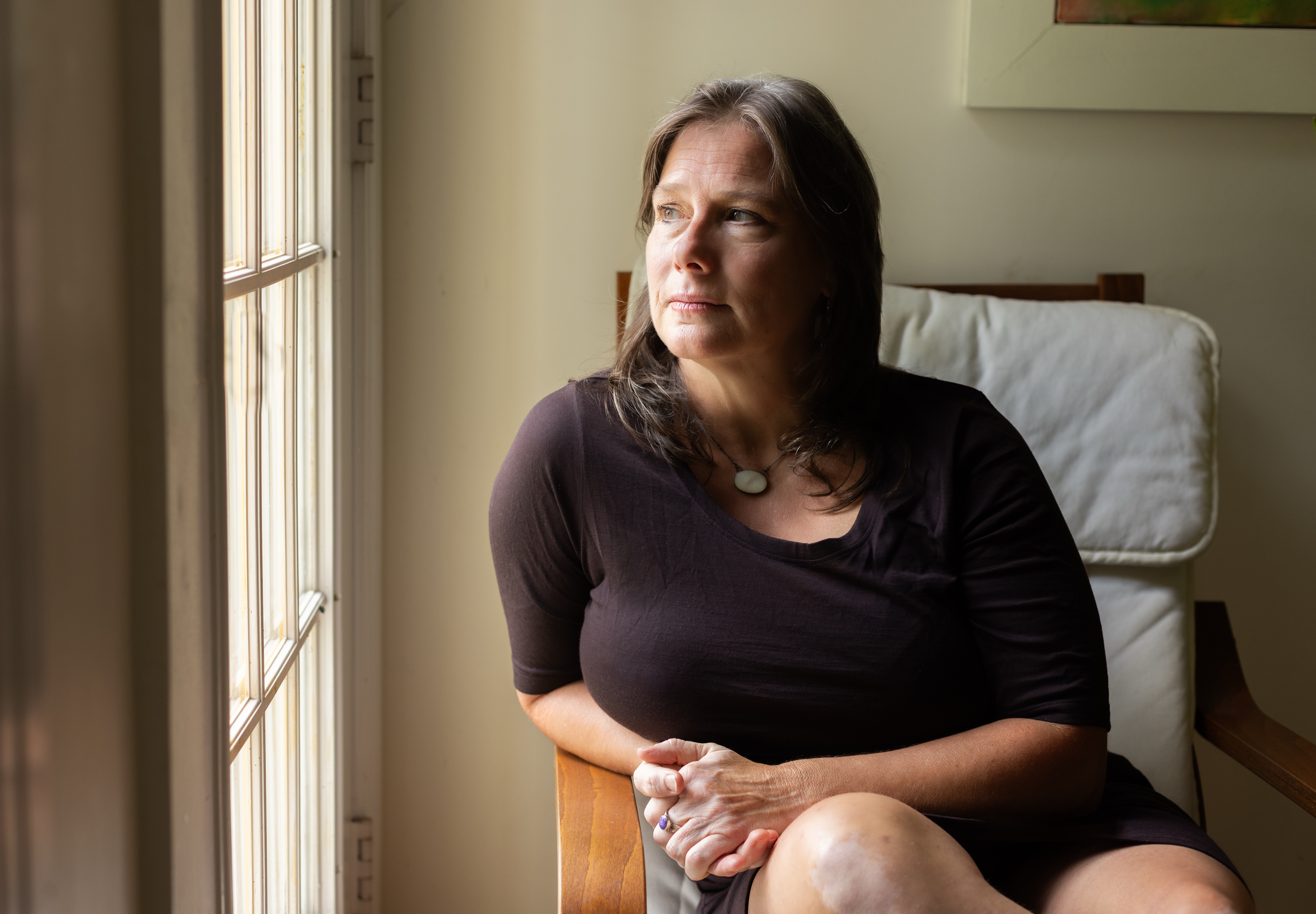 Marcelle Crago, a nurse and lactation consultant in Asheville, North Carolina, needed knee surgery after she tore her meniscus last year. She shopped around and arranged to have the procedure done at an outpatient center, where it cost her less than a third of the price listed by a major local hospital. (Katie Linsky/KFF Health News)
